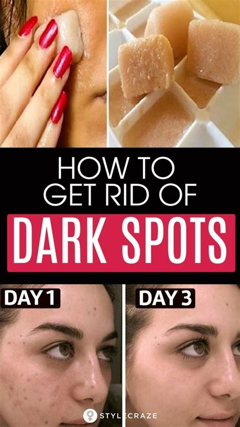 6 Home Remedies To Remove Dark Spots On The Face | Brown spots removal, Dark spots on skin, Acne ...