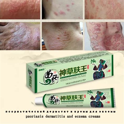 100% Natural Herbal Creams Body Psoriasis Cream Perfect For Dermatitis and Eczema Pruritus ...