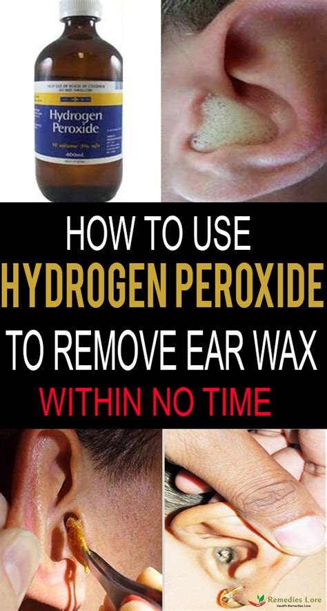 How To Use Hydrogen Peroxide To Remove Ear Wax? - Remedies Lore