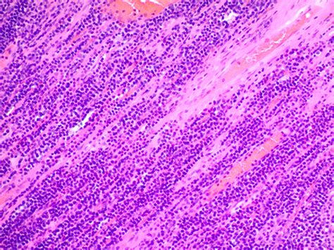 Hematoxylin and Eosin Stain Kit Clinisciences