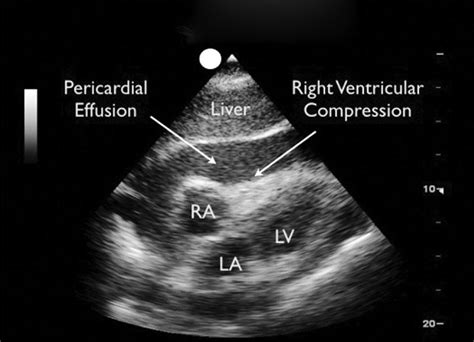 Role of Echocardiography in the Critically Ill Patients | IntechOpen