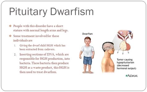 Dwarfism Definition