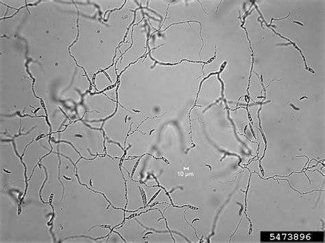 Gibberella crown rot and stalk rot (Gibberella zeae)