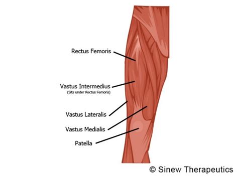 Quadriceps Contusion Charley Horse Information - Sinew Therapeutics