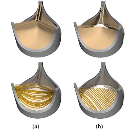 (a) Model porcine bioprosthetic valve geometry and fiber architecture ...