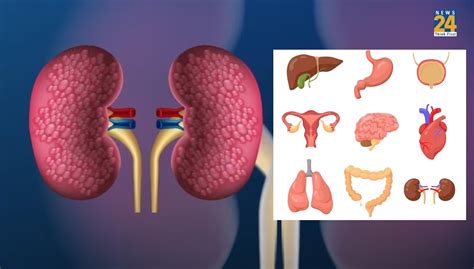 Multiple Organ Failure क्या है? ये 8 संकेत भूलकर भी न करें इग्नोर - Multiple Organ Failure ...