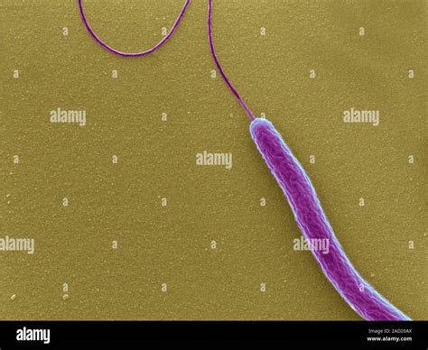 Cholera bacterium. Coloured scanning electron micrograph (SEM) of a Vibrio cholerae bacterium ...