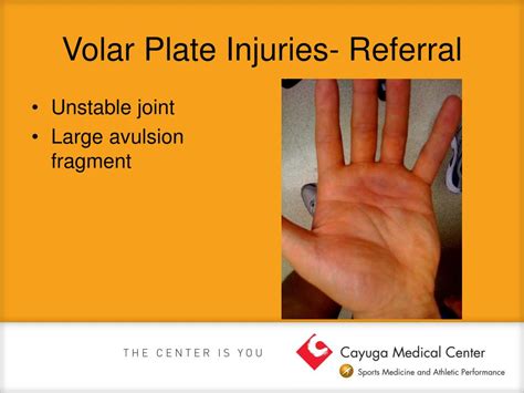 PPT - Common Hand and Wrist Injuries PowerPoint Presentation, free download - ID:3950482