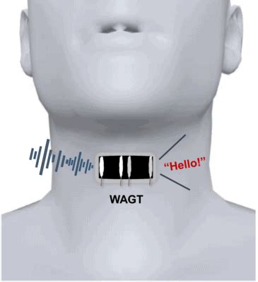 Wearable artificial voice box could help mute people speak