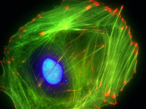 Rac1 GTPase Activity: Role In Lung Cancer Proliferation, Migration, And ...