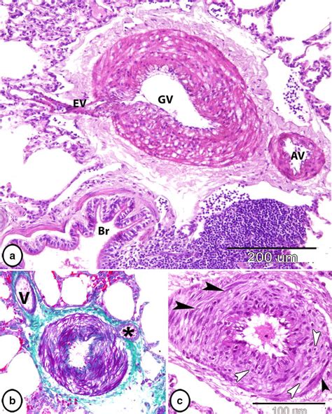 Arteriovenous anastomosis. a Typical glomus organ presents in close to ...