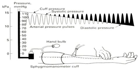 BP Measurement Methods