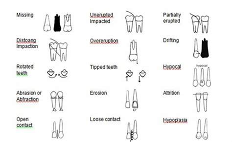 Printable Dental Charting Symbols