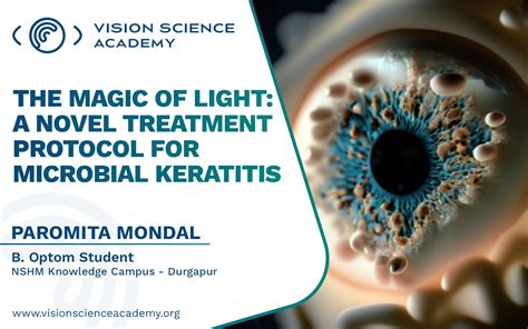 The Magic of Light: A Novel Treatment Protocol for Microbial Keratitis - Vision Science Academy