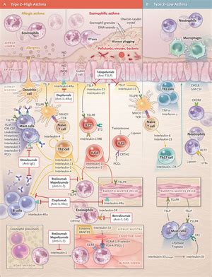 Biologic Therapies for Severe Asthma | NEJM - nejm.org | Gemerlap Bulan