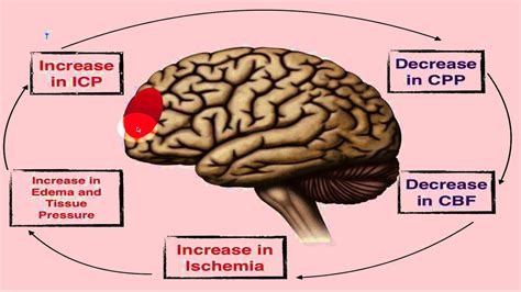 What Does Icp Mean In Medical Terms - mapasgmaes