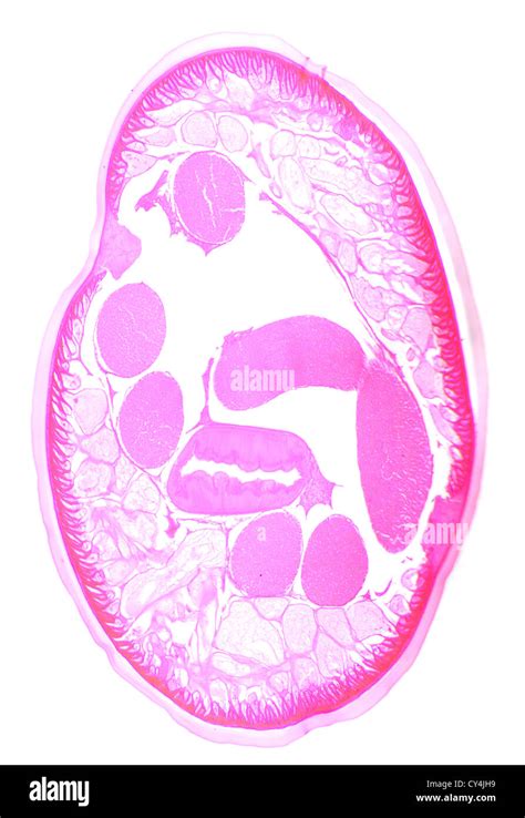 Ascaris under the microscope, background (Ascaris lumbricoides Stock Photo - Alamy