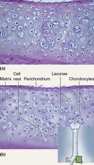 This tissue is hyaline cartilage. Hyaline cartilage is characterized by chondroblasts within a ...