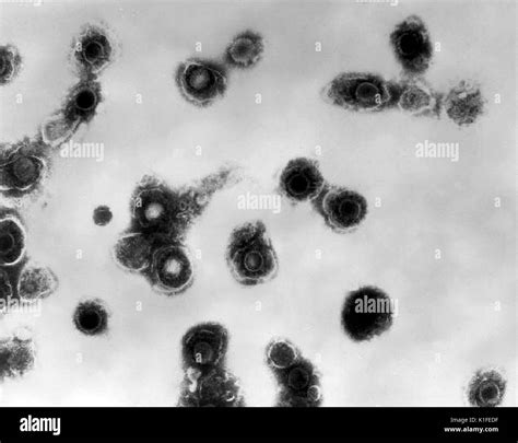 Transmission electron micrograph of varicella-zoster virions from ...