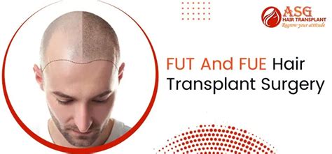 What Is The Difference Between FUE And FUE Hair Transplant Surgery?