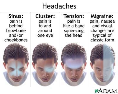 Headaches – Modern Integrative Chiropractic Care