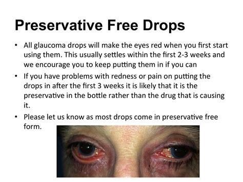 Glaucoma Eye Drops - A Guide For Patients - Clinica London - Harley Street