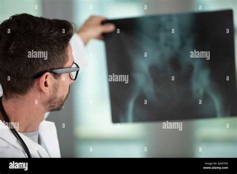 Radiographie pulmonaire Banque de photographies et d’images à haute résolution - Alamy