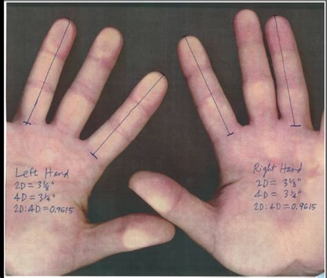 PhilosFX: Finger Length Ratio and Personality, Part 2: Getting Specific