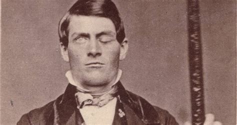 Phineas Gage, The Man Behind History's Most Famous Brain Injury