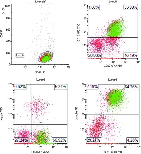 A representative case of the flow cytometric immunophenotype of ...