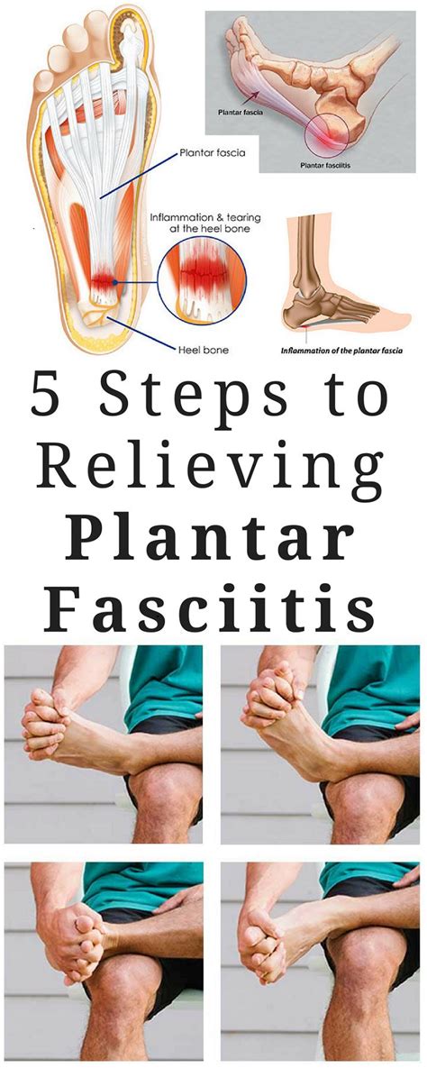 De 1634 bästa Plantar Fasciitis Stretches-bilderna på Pinterest | Enkelt