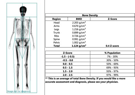 My experience with a DEXA Scan! What is it, and is it worth it? — Whole ...