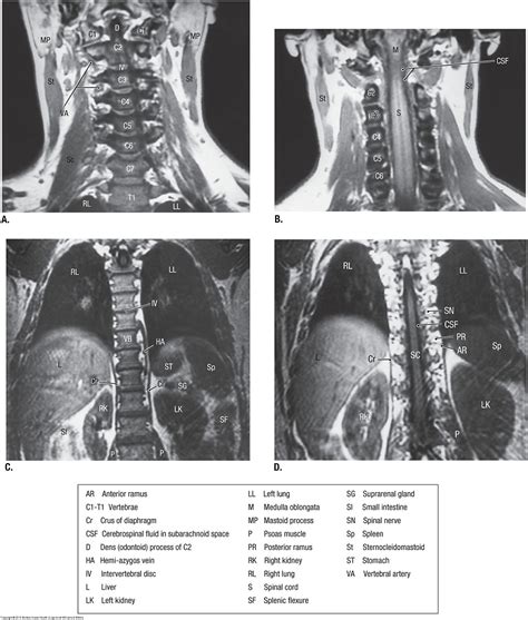 Duke Anatomy - Lab 1: skin and epaxial muscles