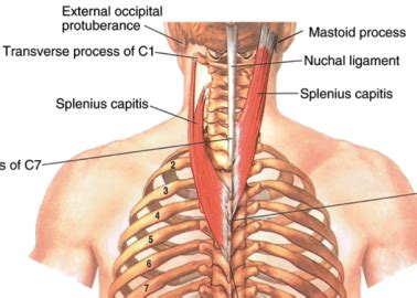 Anatomy of the Ligamentum Nuchae and Upper Thoracic Vertebrae