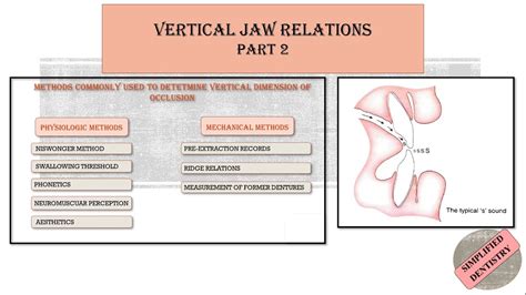 Vertical Jaw Relation | Vertical Dimension of Occlusion | Closest Speaking Space - YouTube