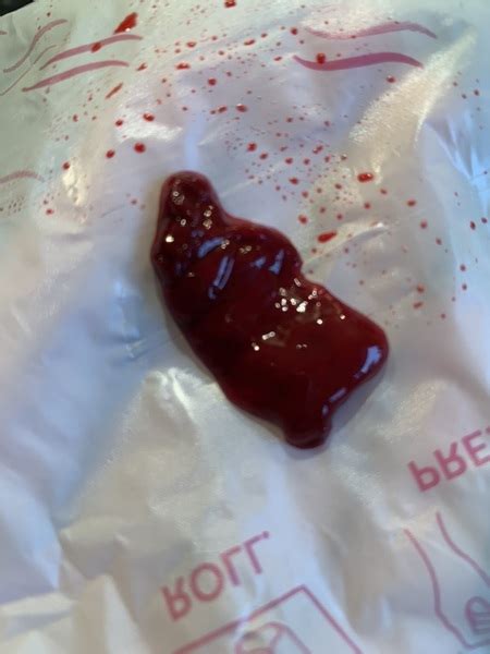 Warning photo! Is this a miscarriage or a big blood clot | Mumsnet