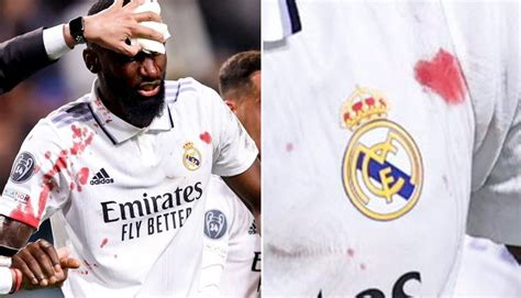 The most viral image: Rudiger's blood drew a heart next to the shield of Real Madrid ...