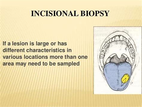 Biopsy ( oral pathology)