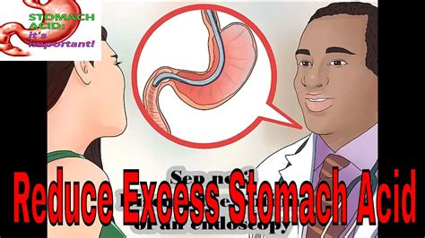 How to Reduce Excess Stomach Acid/ Seeking Medical Attention for GERD - YouTube