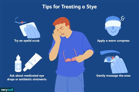 Is It OK to Pop a Stye? — Eye florida