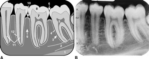 1: Normal Anatomy | Pocket Dentistry