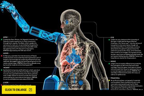 The Latest Artificial Body Parts -- New York Magazine - Nymag