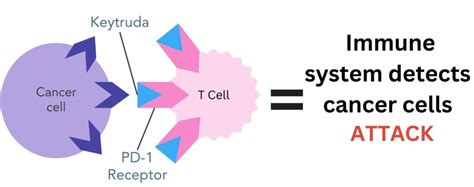 Keytruda for Secondary Breast Cancer: Science and Stories - OWise UK