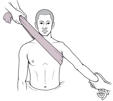 Figure: Traction-countertraction technique for reducing anterior shoulder dislocations - MSD ...