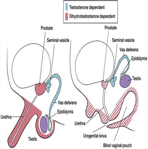 5 alpha reductase deficiency causes, symptoms, diagnosis & treatment