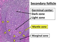 Germinal center - Wikipedia