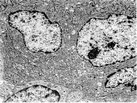 Electron micrograph o f multinucleated, osteoclast-like giant cell x... | Download Scientific ...