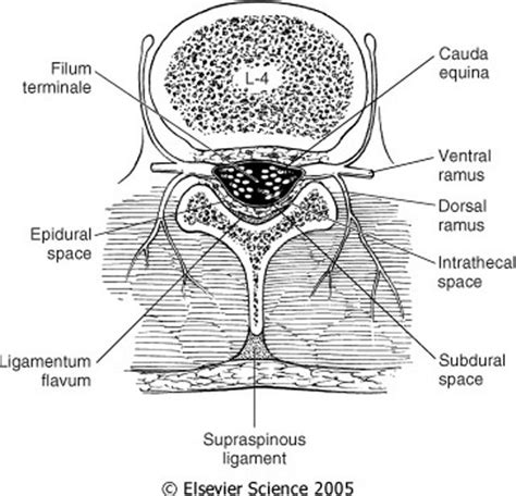 Thoracic Epidural Anatomy