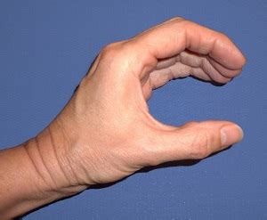 Exercise for a Painful Thumb CMC Joint?