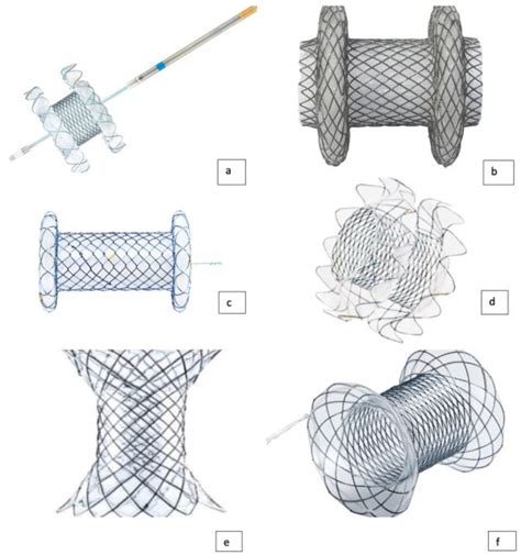 (a) Hot-Spaxus stent (TaeWoong Medical); (b) Axios stent (Boston ...